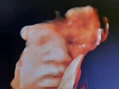 Dr ROUIDI+Gynecologist Dr ROUIDI+Gynecologist