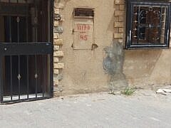 Dr HAMROUN Hassina+pulmonologist Dr HAMROUN Hassina+pulmonologist