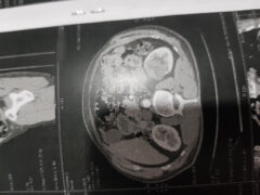 Dr Ammari toufik-Urologist Dr Ammari toufik-Urologist