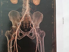 Dr Nehnouh-Vascular surgeon Dr Nehnouh-Vascular surgeon