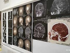 Dr Cherrak el ghosli-Radiologist Dr Cherrak el ghosli-Radiologist