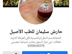 حارش سليمان للطب الأصيل والحجامة-Cupping حارش سليمان للطب الأصيل والحجامة-Cupping