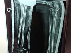 Dr MESLEM+Orthopedist Dr MESLEM+Orthopedist