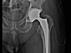 Dr A.mahgoun-Orthopedist Dr A.mahgoun-Orthopedist