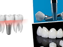 Dr Mazzi leila-Dentiste Dr Mazzi leila-Dentiste