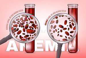 مستويات الهيموجلوبين, Taux d'hémoglobine, Hemoglobin levels