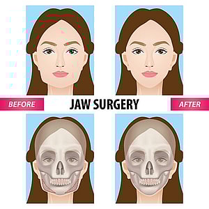 Maxillofacial Surgeon