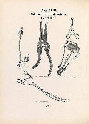 What is Pseudocystogastrostomy: Overview, Benefits, and Expected Results