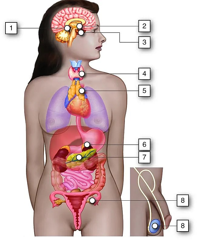 What is Placement of Radiotherapy Afterloading Expandable Catheter Following Partial Mastectomy: Overview, Benefits, and Expected Results