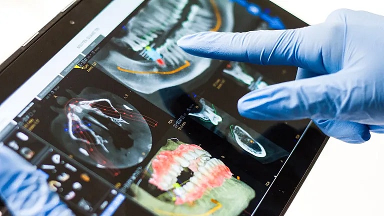 What is Pre-Surgery Follow-Up: Overview, Benefits, and Expected Results