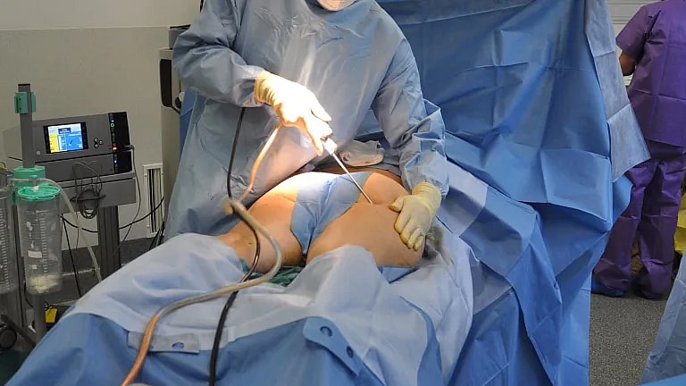 What is Reconstructive Surgery Consultation: Overview, Benefits, and Expected Results