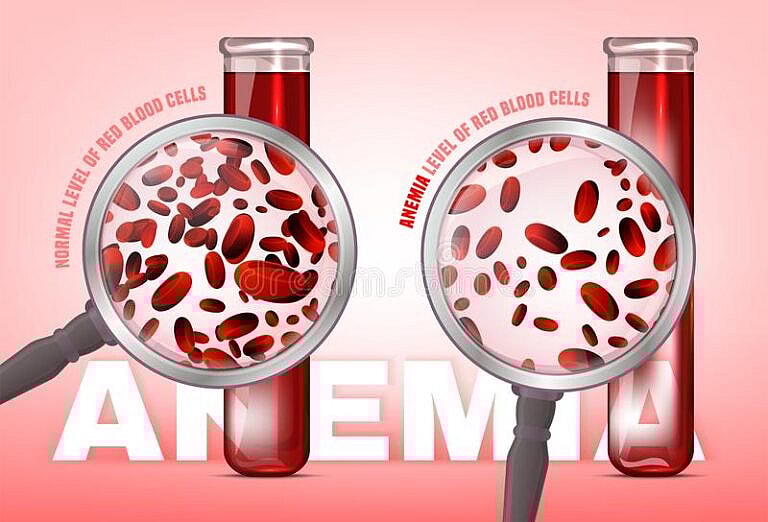 مستويات الهيموجلوبين, Taux d'hémoglobine, Hemoglobin levels