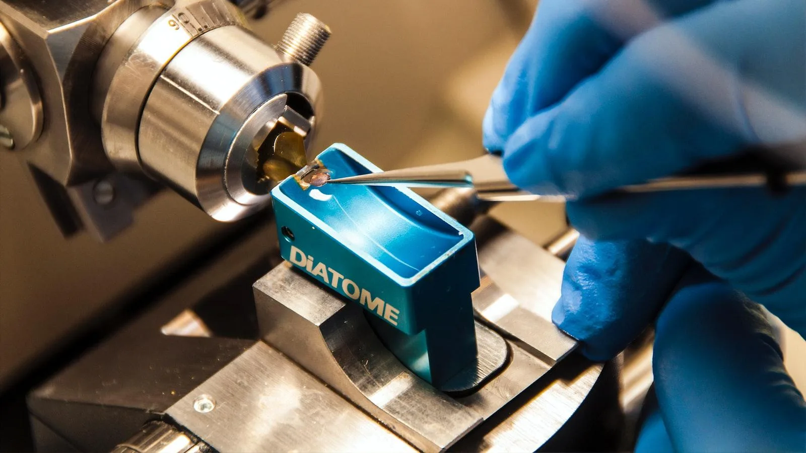 What Are Prostate Laser Procedures Overview, Benefits, And Expected Results Adoctor