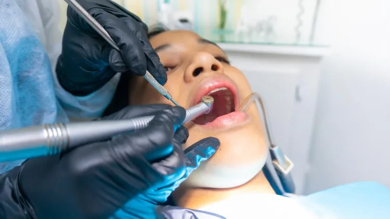 What is Prosthodontics: Definition and Overview