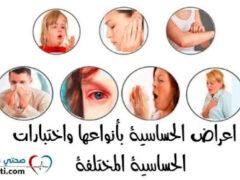 Dr Ouali Mohamed+allergist