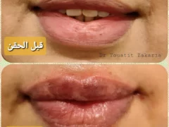 Dr Touatit Zakaria+Plastic surgeon