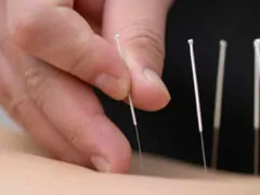 Dr Kamel henni-Acupuncturist