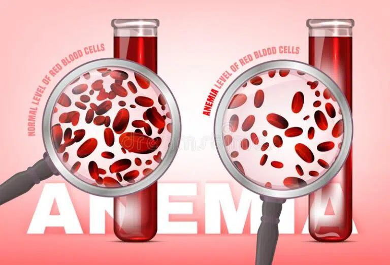 مستويات الهيموجلوبين, Taux d'hémoglobine, Hemoglobin levels