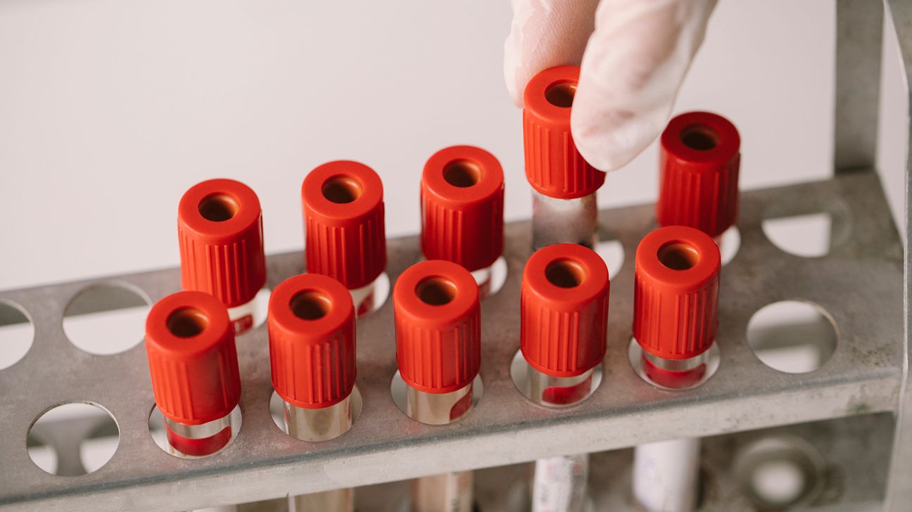 An assortment of blood test tubes.