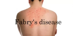 What is Fabry Disease? d0af49cbd7d72e1647be673883a0ccfb.png