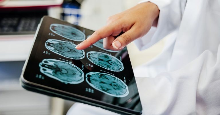 Can You Shrink a Pituitary Tumor Naturally? What to Know