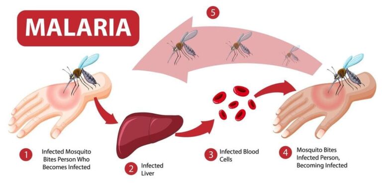 ما هي الملاريا، ما هي الملاريا، Qu & #039؛ est-ce que le paludisme